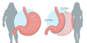 Услуги врача-хирурга Бацикова Хайрулы Абдулганиевича в Махачкале