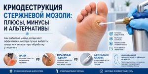 Криодеструкция стержневой мозоли: плюсы, минусы и альтернативы